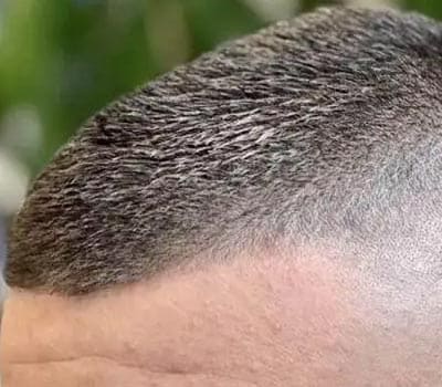 Hairfinity生发防脱