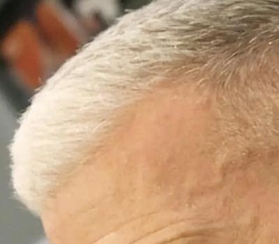 Hairfinity生发防脱